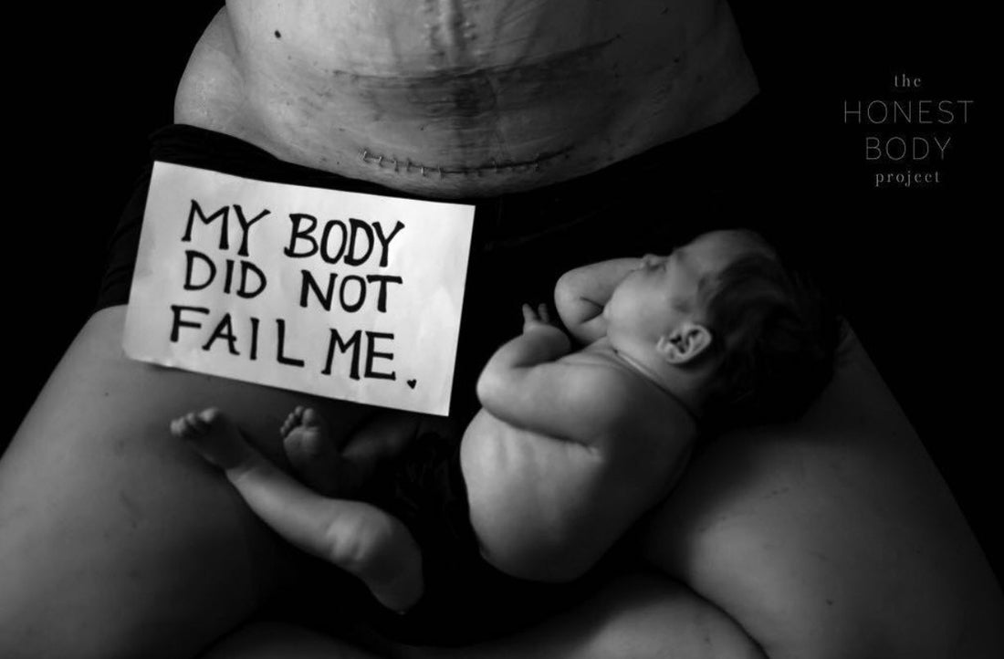 Episode 33 - Dr Joseph Sgroi - C section 101 - Lenny Rose